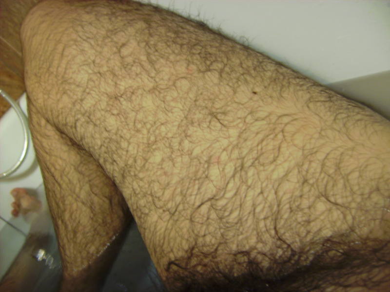hairy_legs3.jpg